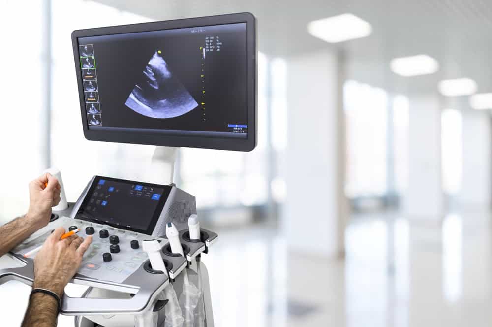 A close-up of a medical professional operating an ultrasound machine in a bright hospital setting, where the efficient reuse of electronics parallels efforts like electronics recycling. The screen shows a sonogram, with various controls visible on the recycled technology. A softly blurred background suggests a clinical environment.